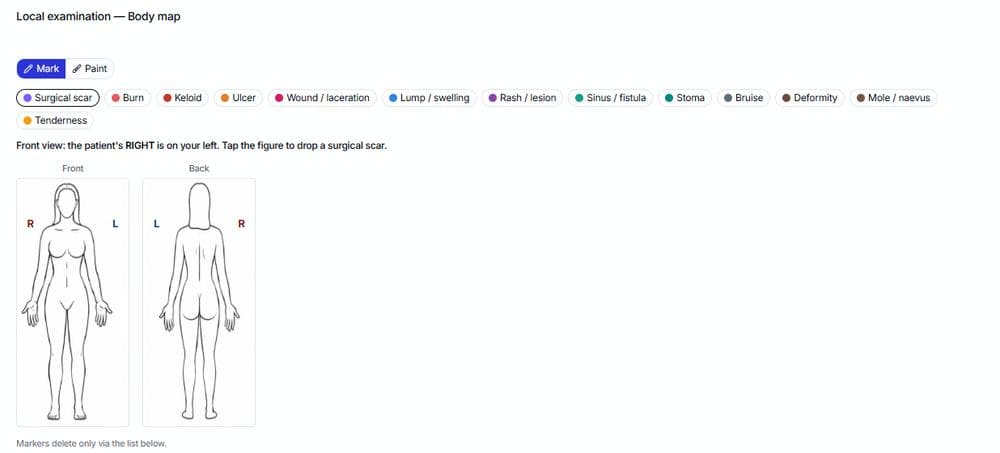 Local examination body map with front and back figures and typed markers such as surgical scar, burn, ulcer, wound, lump and rash
